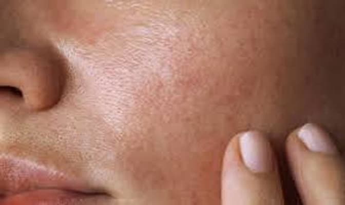 View Gallery Image #1