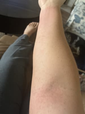 View Gallery Image #1