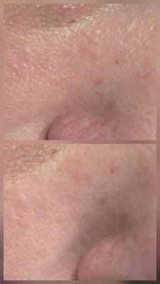 View Gallery Image #1