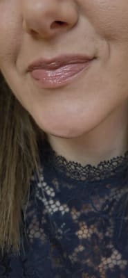 View Gallery Image #1