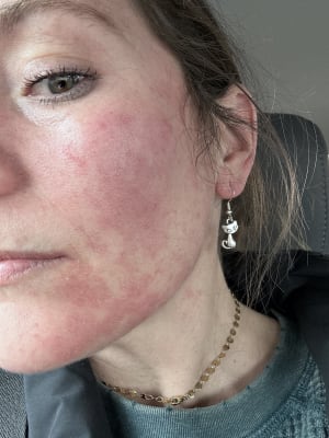 View Gallery Image #1