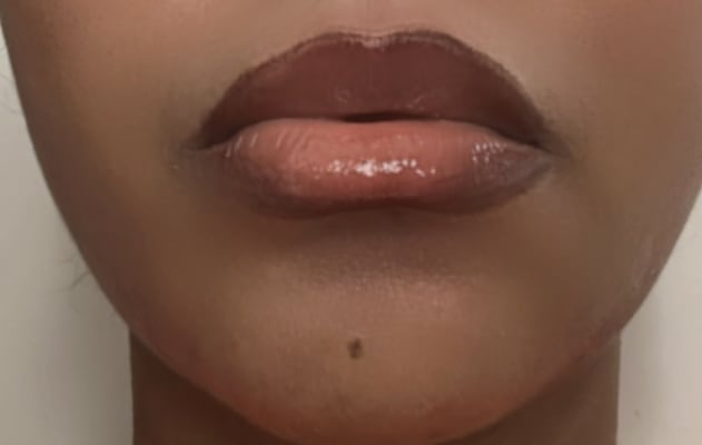 View Gallery Image #1