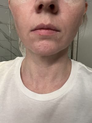 View Gallery Image #1