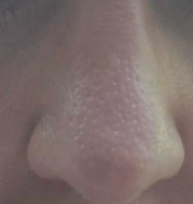 View Gallery Image #1