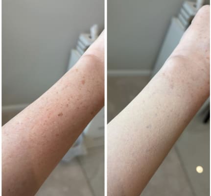 View Gallery Image #1