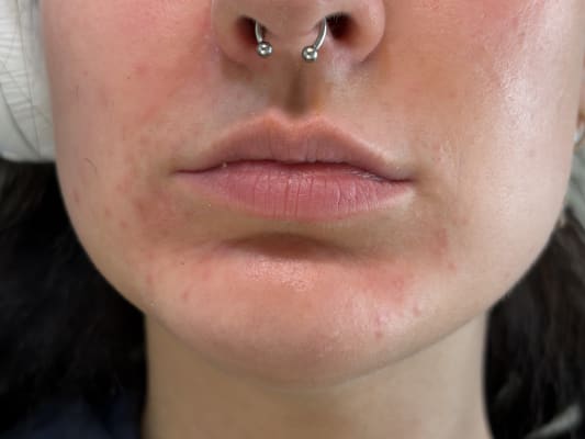 View Gallery Image #1