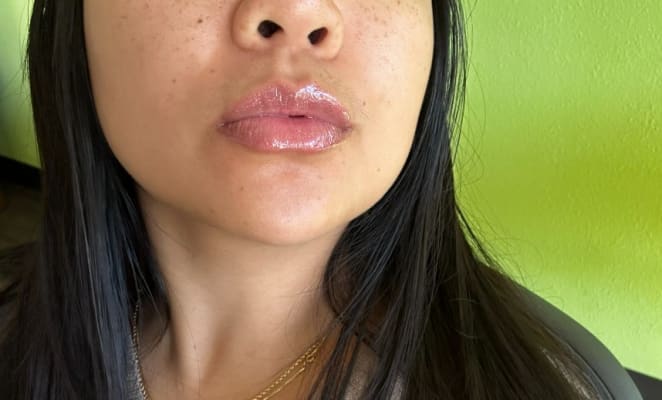 View Gallery Image #1