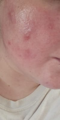 View Gallery Image #1