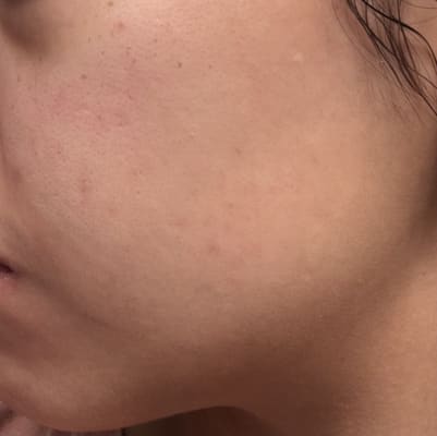 View Gallery Image #1