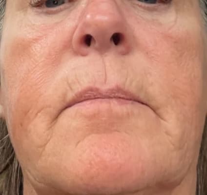 View Gallery Image #6