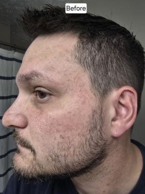 View Gallery Image #1