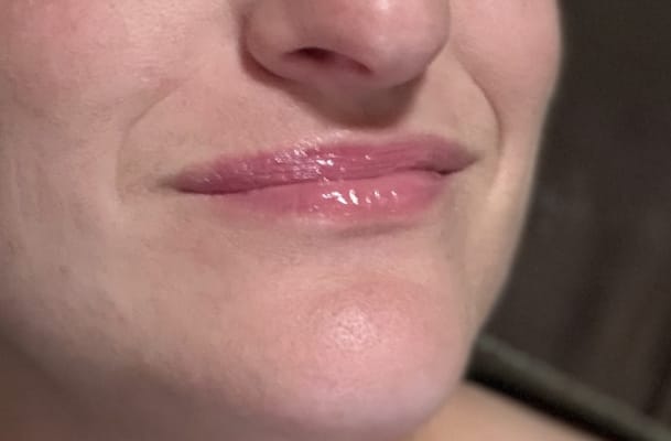 View Gallery Image #11