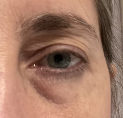 View Gallery Image #11