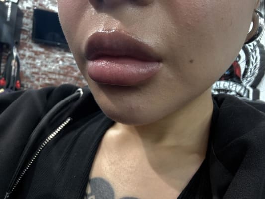 View Gallery Image #1