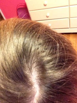 Suave Suave Max Hold Non Aerosol Hairspray 11 Oz Big Lots