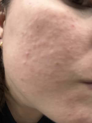 View Gallery Image #1