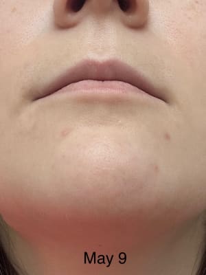 View Gallery Image #1