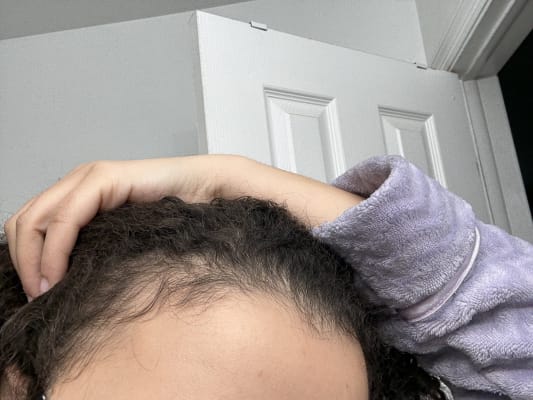 View Gallery Image #1