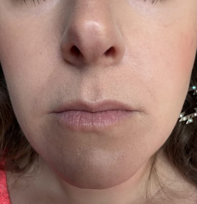 View Gallery Image #1