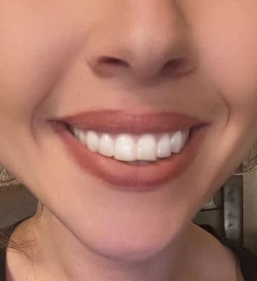 View Gallery Image #1