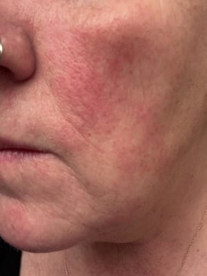 View Gallery Image #1