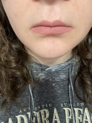 View Gallery Image #15