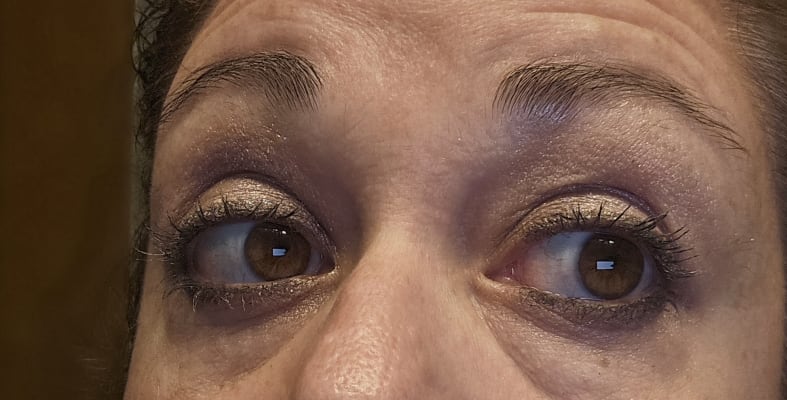 View Gallery Image #1