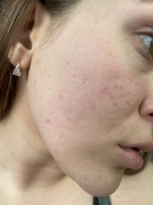 View Gallery Image #1