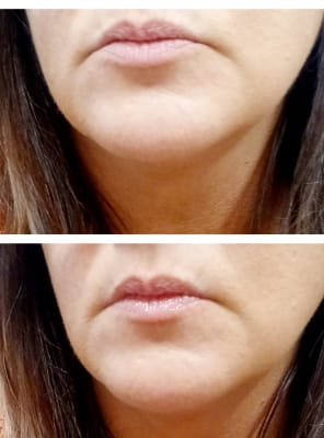 View Gallery Image #1