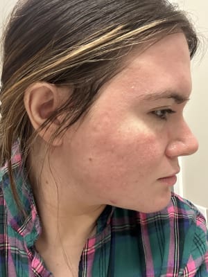 View Gallery Image #1