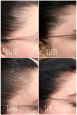 View Gallery Image #1