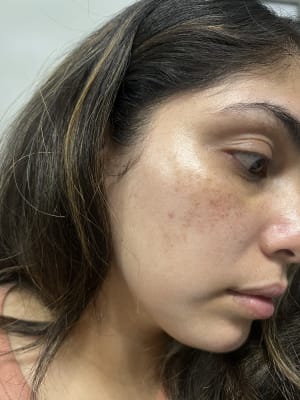 View Gallery Image #1