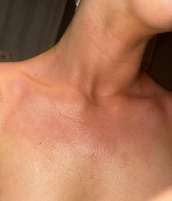 View Gallery Image #1