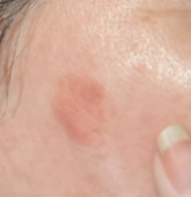 View Gallery Image #1