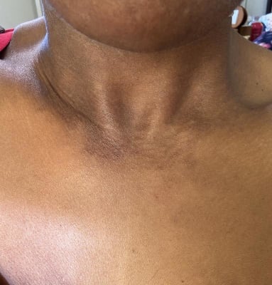 View Gallery Image #1