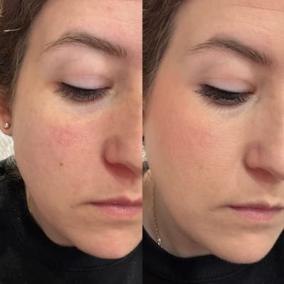 View Gallery Image #1