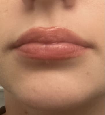 View Gallery Image #5