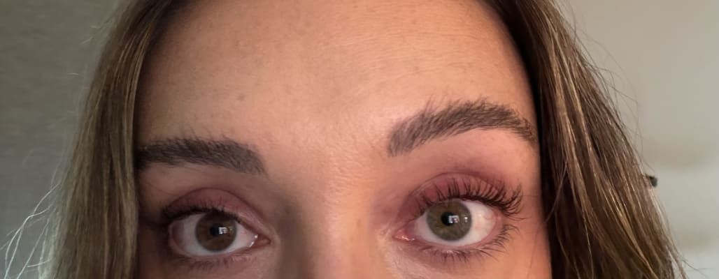 View Gallery Image #1