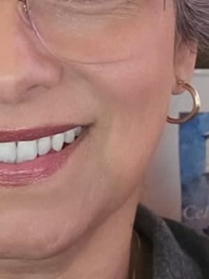 View Gallery Image #1