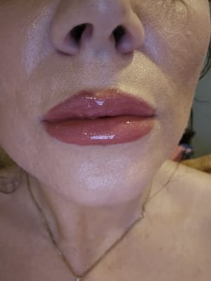 View Gallery Image #1