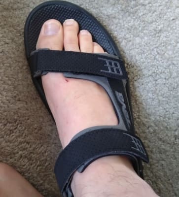 Teva minam review clearance