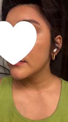 View Gallery Image #1