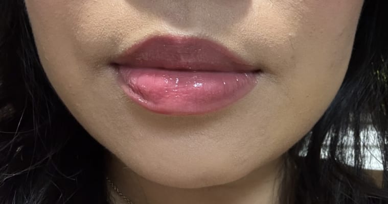 View Gallery Image #2