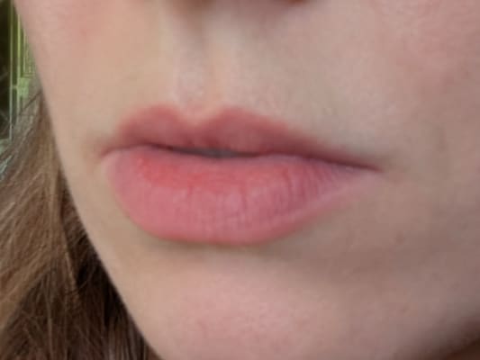 View Gallery Image #7
