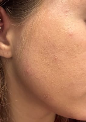 View Gallery Image #1