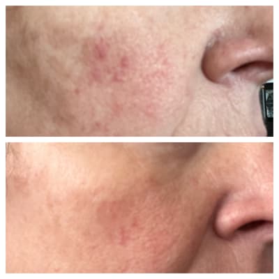 View Gallery Image #1