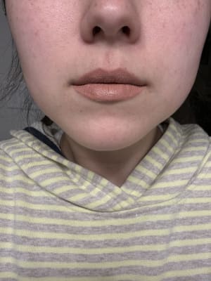 View Gallery Image #11