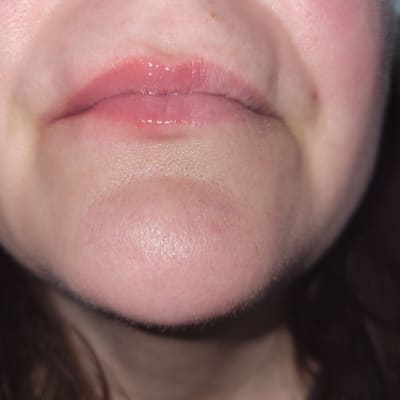 View Gallery Image #1