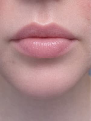 View Gallery Image #3