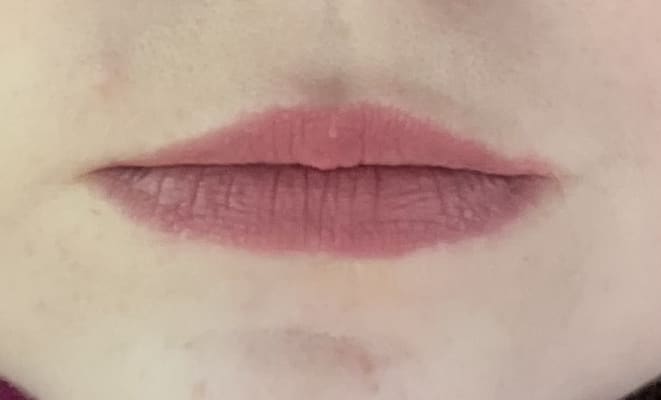 View Gallery Image #1